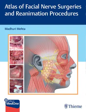 Mehta |  Atlas of Facial Nerve Surgeries and Reanimation Procedures | Buch |  Sack Fachmedien