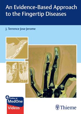 Jerome |  An Evidence-Based Approach to the Fingertip Diseases | Buch |  Sack Fachmedien