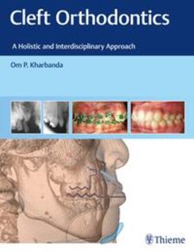 Kharbanda |  Cleft Orthodontics | eBook | Sack Fachmedien