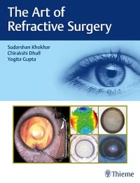 Khokhar / Dhull / Gupta |  The Art of Refractive Surgery | eBook | Sack Fachmedien