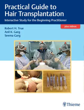 True / Garg |  Practical Guide to Hair Transplantation | eBook | Sack Fachmedien