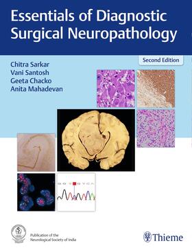 Sarkar / Santosh / Chacko |  Essentials of Diagnostic Surgical Neuropathology | Buch |  Sack Fachmedien