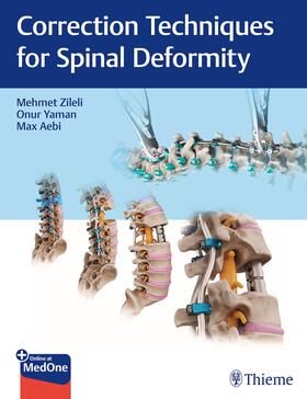 Zileli / Yaman / Aebi |  Correction Techniques for Spinal Deformity | eBook | Sack Fachmedien