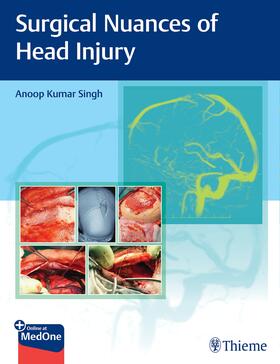 Singh |  Surgical Nuances of Head Injury | Buch |  Sack Fachmedien