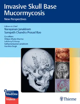 Janakiram / Prasad Rao |  Invasive Skull Base Mucormycosis | eBook | Sack Fachmedien