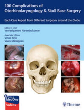 Narendrakumar |  100 Complications of Otorhinolaryngology & Skull Base Surgery | eBook | Sack Fachmedien