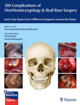 Narendrakumar / Felix / Mariappan |  100 Complications of Otorhinolaryngology & Skull Base Surgery | Buch |  Sack Fachmedien