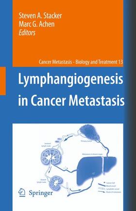 Achen / Stacker |  Lymphangiogenesis in Cancer Metastasis | Buch |  Sack Fachmedien