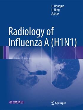 Li |  Radiology of Influenza A (H1N1) | Buch |  Sack Fachmedien
