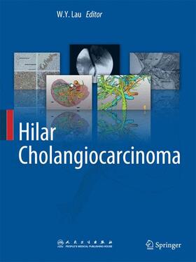 Lau |  Hilar Cholangiocarcinoma | Buch |  Sack Fachmedien