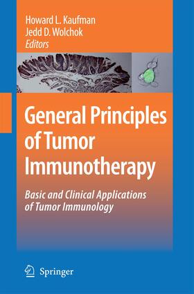 Wolchok / Kaufman |  General Principles of Tumor Immunotherapy | Buch |  Sack Fachmedien