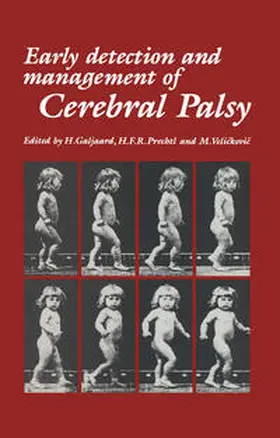 Galjaard / Prechtl / Velickovic |  Early Detection and Management of Cerebral Palsy | eBook | Sack Fachmedien