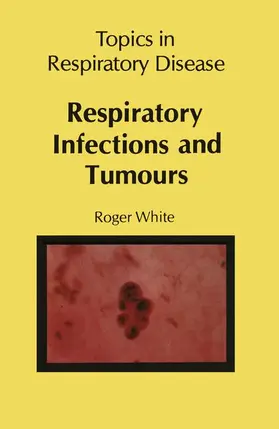 White |  Respiratory Infections and Tumours | Buch |  Sack Fachmedien