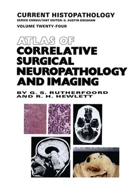 Hewlett / Rutherfoord |  Atlas of Correlative Surgical Neuropathology and Imaging | Buch |  Sack Fachmedien