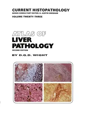 Wight |  Atlas of Liver Pathology | Buch |  Sack Fachmedien