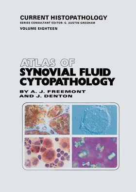 Denton / Freemont |  Atlas of Synovial Fluid Cytopathology | Buch |  Sack Fachmedien