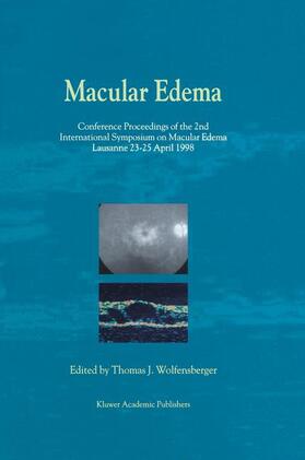 Wolfensberger |  Macular Edema | Buch |  Sack Fachmedien