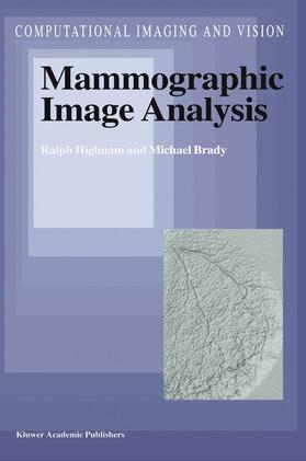 Brady / Highnam |  Mammographic Image Analysis | Buch |  Sack Fachmedien