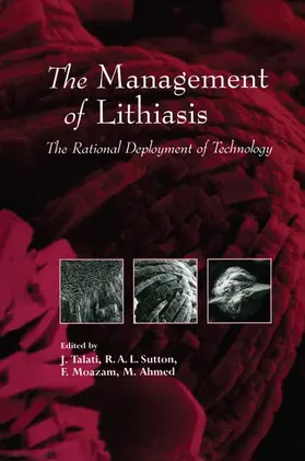 Talati / Ahmed / Sutton |  The Management of Lithiasis | Buch |  Sack Fachmedien