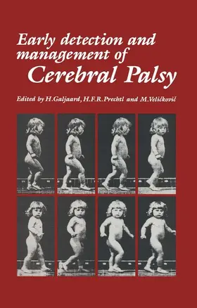 Galjaard / Velickovic / Prechtl |  Early Detection and Management of Cerebral Palsy | Buch |  Sack Fachmedien