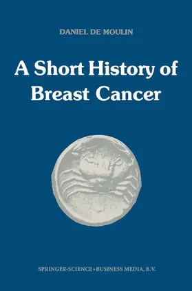 de Moulin |  A short history of breast cancer | Buch |  Sack Fachmedien