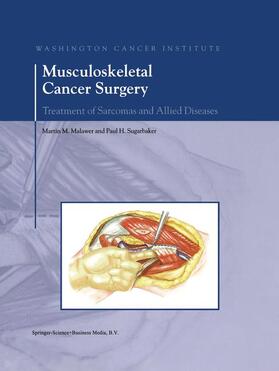 Sugarbaker / Malawer |  Musculoskeletal Cancer Surgery | Buch |  Sack Fachmedien