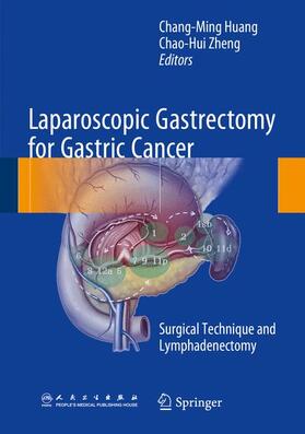 Huang / Zheng |  Laparoscopic Gastrectomy for Gastric Cancer | Buch |  Sack Fachmedien