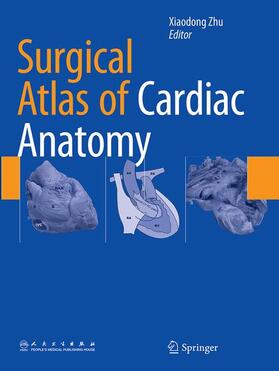 Zhu |  Surgical Atlas of Cardiac Anatomy | Buch |  Sack Fachmedien