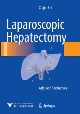 Cai |  Laparoscopic Hepatectomy | Buch |  Sack Fachmedien