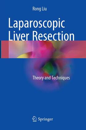 Liu |  Laparoscopic Liver Resection | Buch |  Sack Fachmedien