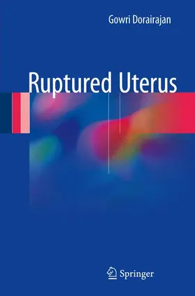 Dorairajan |  Ruptured Uterus | Buch |  Sack Fachmedien