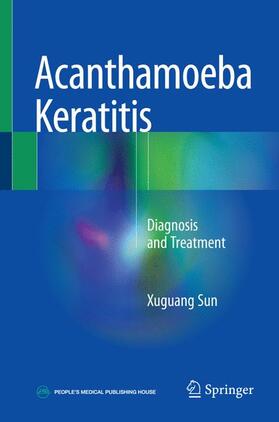 Sun |  Acanthamoeba Keratitis | Buch |  Sack Fachmedien