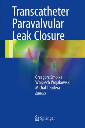 Smolka / Tendera / Wojakowski |  Transcatheter Paravalvular Leak Closure | Buch |  Sack Fachmedien