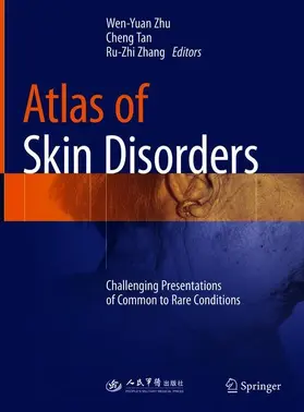 Zhu / Zhang / Tan |  Atlas of Skin Disorders | Buch |  Sack Fachmedien