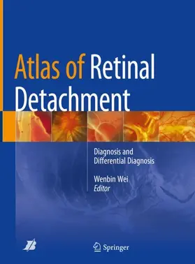 Wei |  Atlas of Retinal Detachment | Buch |  Sack Fachmedien