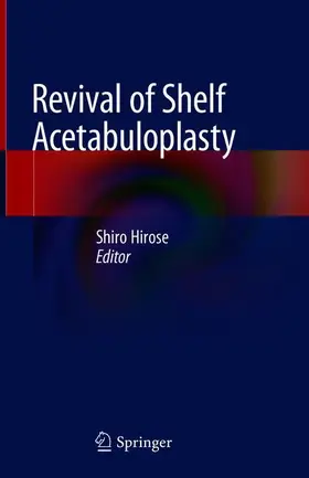 Hirose |  Revival of Shelf Acetabuloplasty | Buch |  Sack Fachmedien