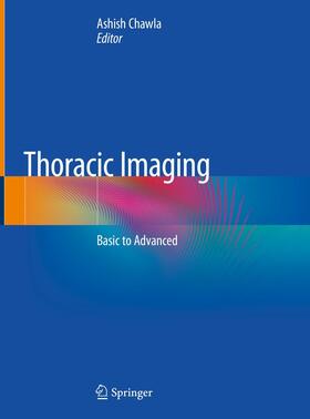 Chawla |  Thoracic Imaging | Buch |  Sack Fachmedien