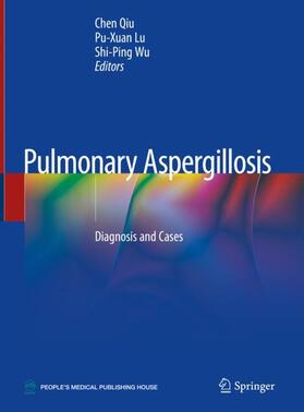 Qiu / Wu / Lu |  Pulmonary Aspergillosis | Buch |  Sack Fachmedien
