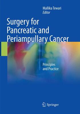 Tewari |  Surgery for Pancreatic and Periampullary Cancer | Buch |  Sack Fachmedien