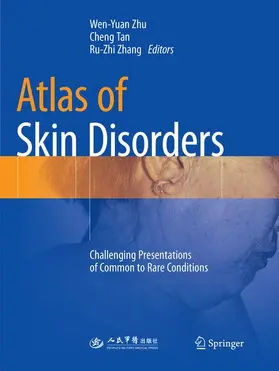 Zhu / Zhang / Tan |  Atlas of Skin Disorders | Buch |  Sack Fachmedien