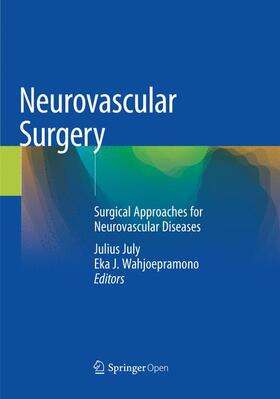 Wahjoepramono / July |  Neurovascular Surgery | Buch |  Sack Fachmedien