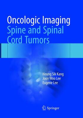 Kang / Lee |  Oncologic Imaging: Spine and Spinal Cord Tumors | Buch |  Sack Fachmedien