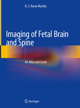 Rama Murthy |  Imaging of Fetal Brain and Spine | eBook | Sack Fachmedien