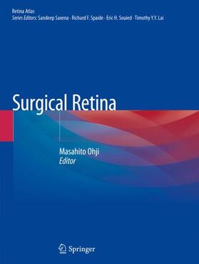 Ohji |  Surgical Retina | Buch |  Sack Fachmedien