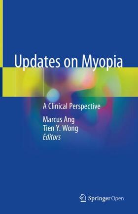 Wong / Ang |  Updates on Myopia | Buch |  Sack Fachmedien