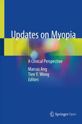 Wong / Ang |  Updates on Myopia | Buch |  Sack Fachmedien