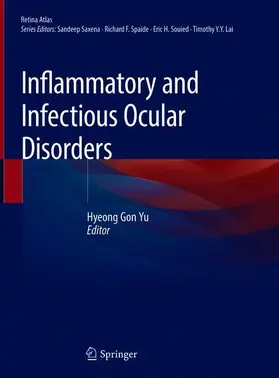 Yu |  Inflammatory and Infectious Ocular Disorders | Buch |  Sack Fachmedien