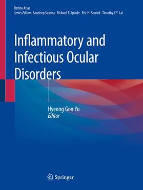 Yu |  Inflammatory and Infectious Ocular Disorders | Buch |  Sack Fachmedien