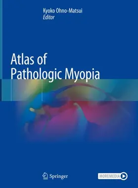 Ohno-Matsui |  Atlas of Pathologic Myopia | Buch |  Sack Fachmedien