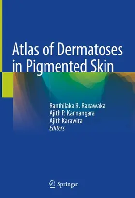 Ranawaka / Karawita / Kannangara |  Atlas of Dermatoses in Pigmented Skin | Buch |  Sack Fachmedien